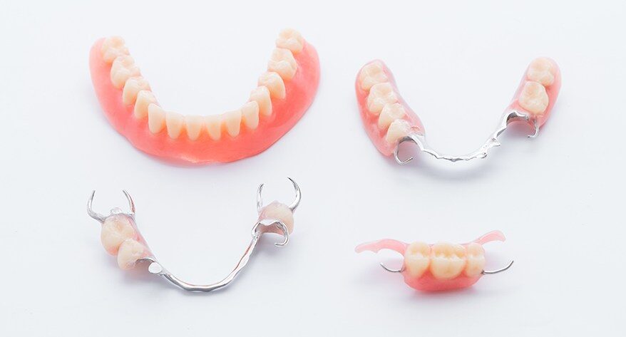 Options for Replacement Teeth