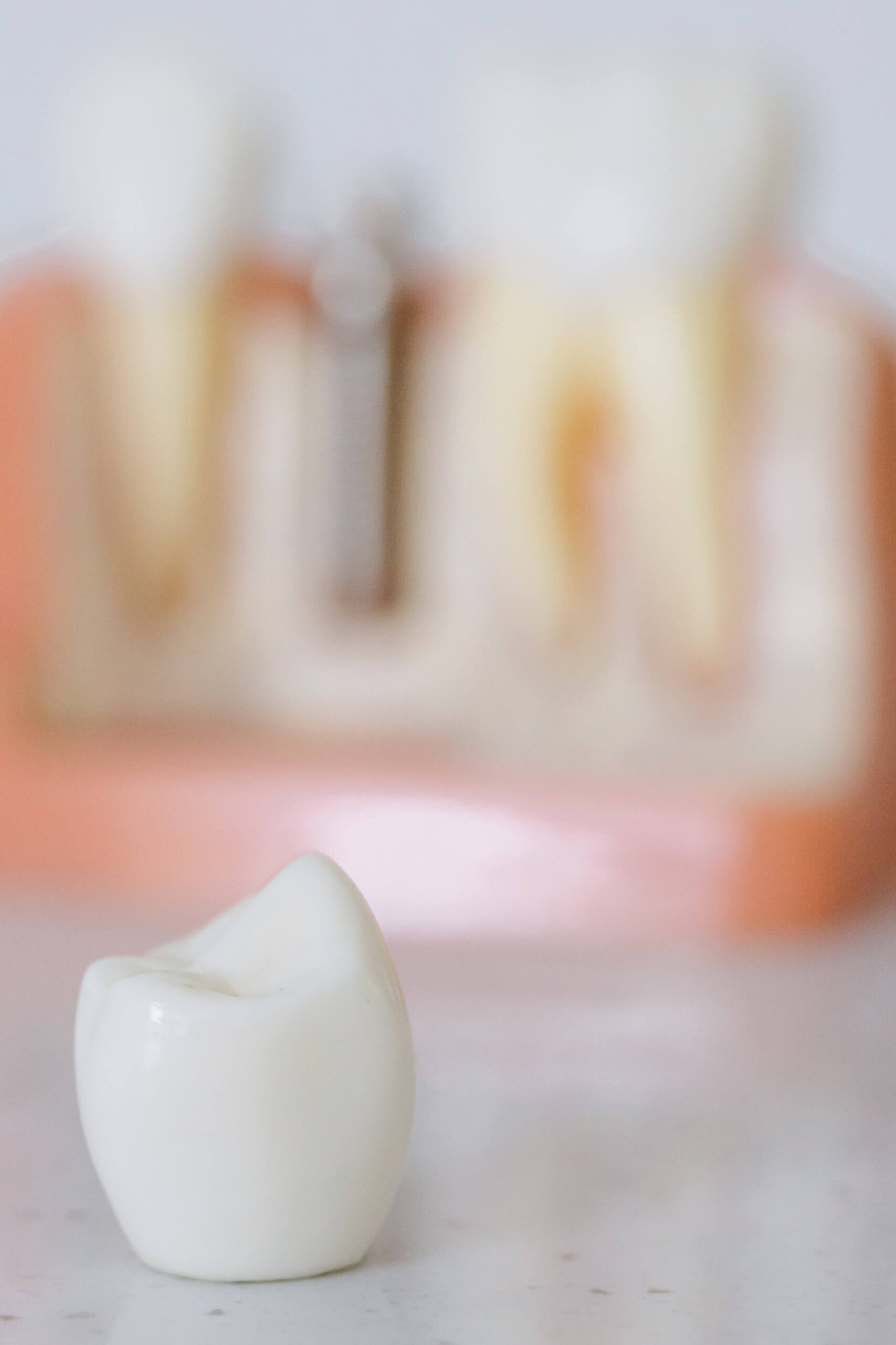 Dental Crowns and Bridges in Mesa, AZ
