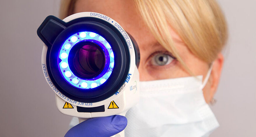 Oral cancer screening