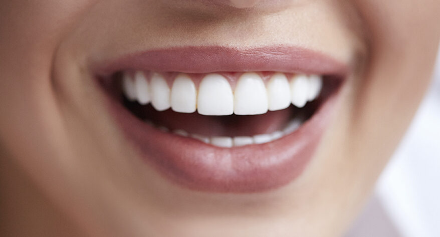 Fluoride Treatment